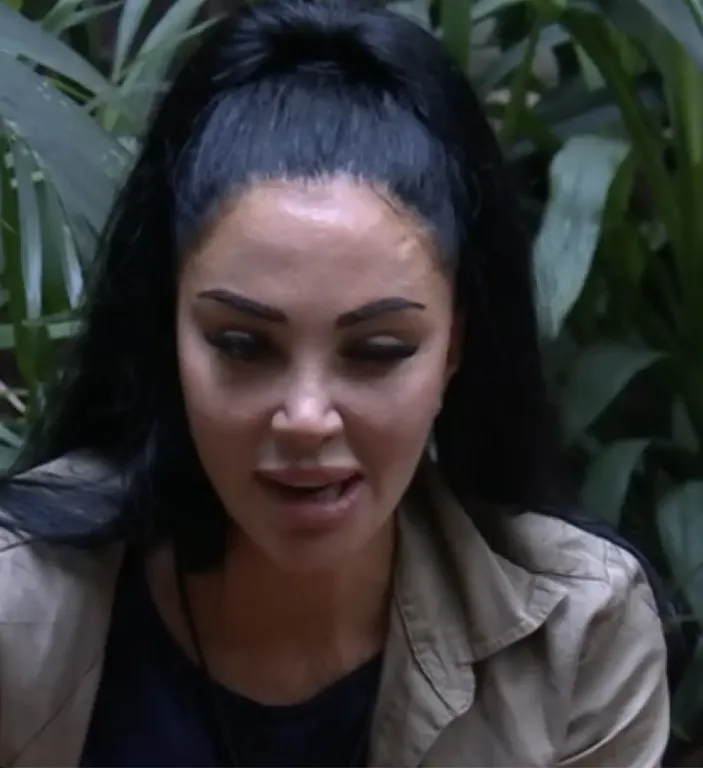 Tulisa rejtélyes mentessége az I’m A Celeb próbáján-1