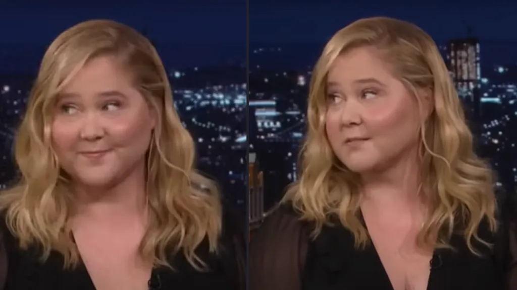 Amy Schumer sokkoló diagnózisa: Cushing-szindróma-3
