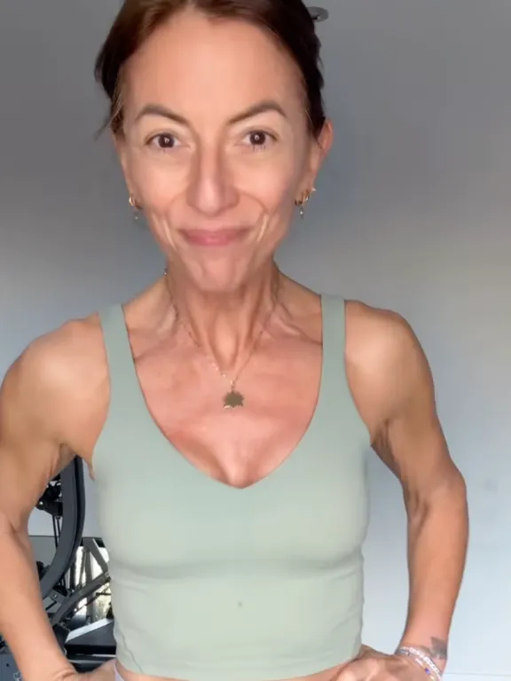 Davina McCall sokkoló vallomása az agydaganatról-2