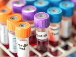 Hepatitis A test kémcsövek