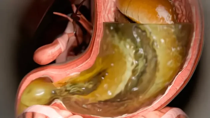 All side effects of Ozempic as simulation shows true reality of what jab does to your body