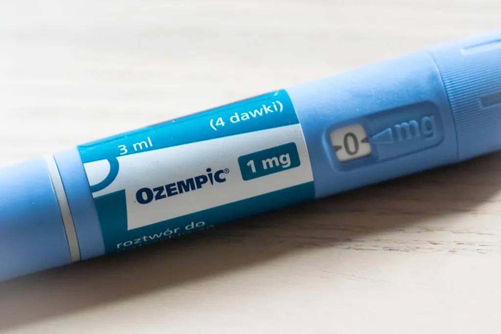 Énekesnő sokkoló Ozempic-mellékhatása: csontritkulás-2