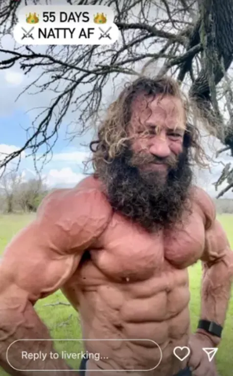 Liver King botrány: Szteroidhasználat és Netflix-doksi-3