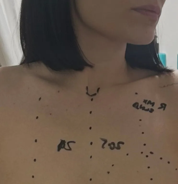 Jessie J őszintén a mellrák elleni küzdelméről-3