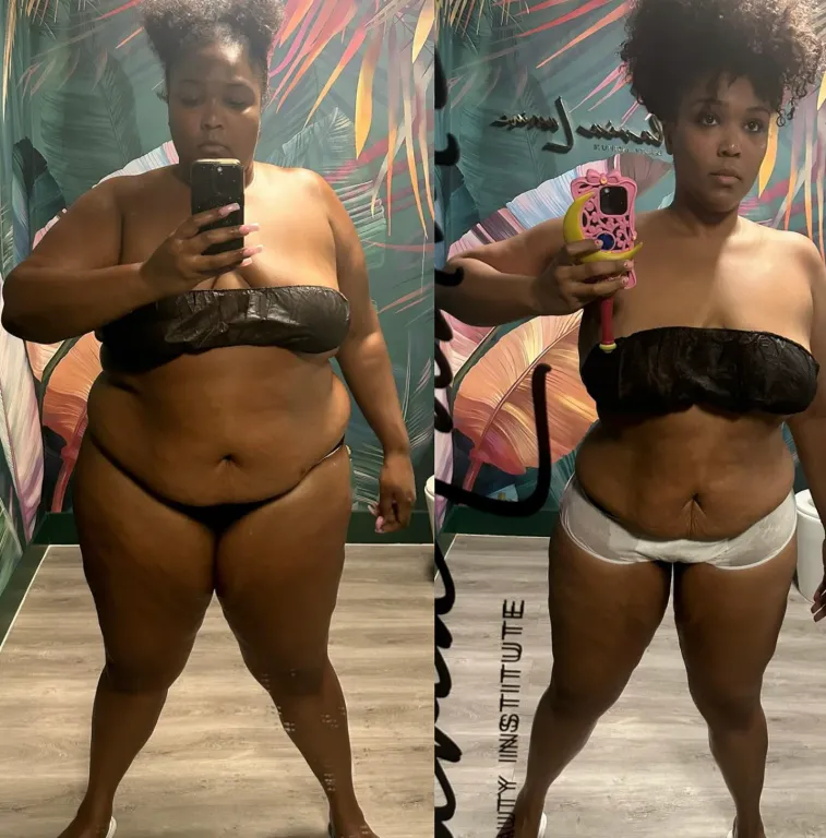 Lizzo lerántja a leplet: Az igazság a fogyásáról-1