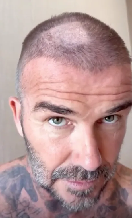 David Beckham sokkoló hajbalesete: Victoria trollkodik-3