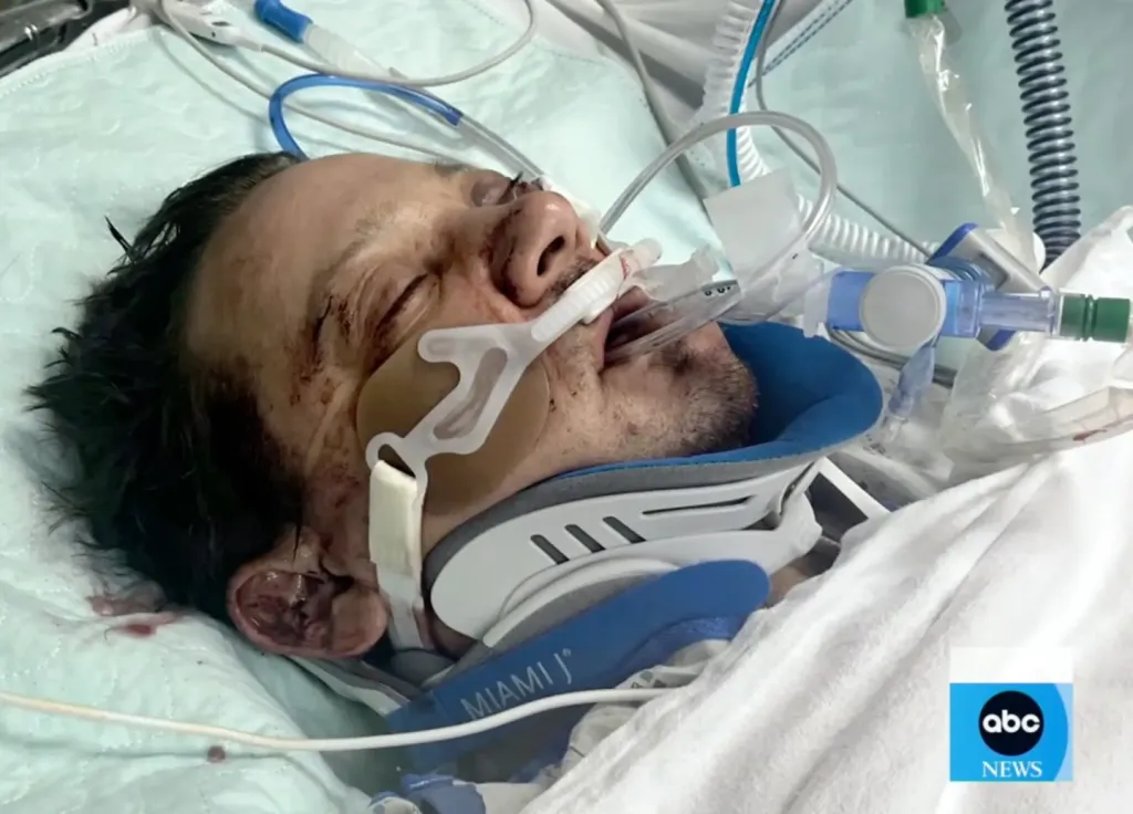 Jeremy Renner: Mit látott, amikor ‘meghalt’ a hómaró balesetben?-2