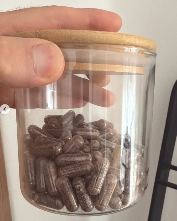 Sokk: Calvin Harris megmutatta a méhlepényt fia születésekor!-2