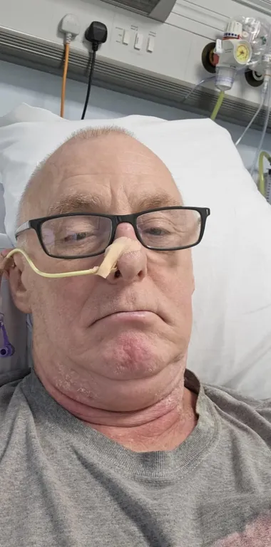 Orális szex veszélye: Szájrák leselked idősebb korban!-1