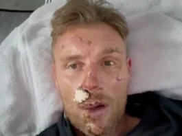 Flintoff szívszorító vallomása a Top Gear balesetről Freddie Flintoff makes heartbreaking admission about near-fatal Top Gear crash
