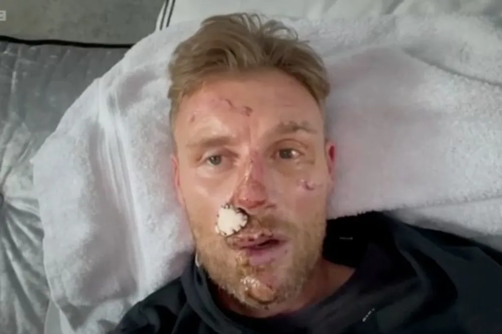 Flintoff szívszorító vallomása a Top Gear balesetről-2