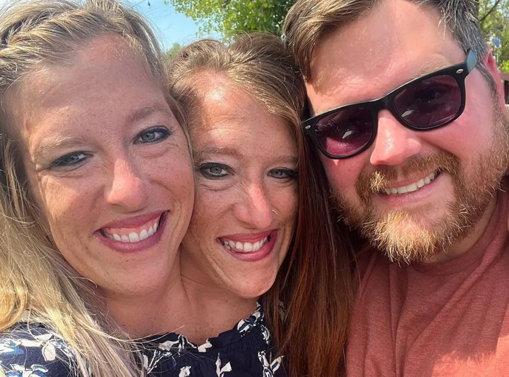 Siameszi ikrek babával: Anya elárulta, lehet-e gyerekük?-1