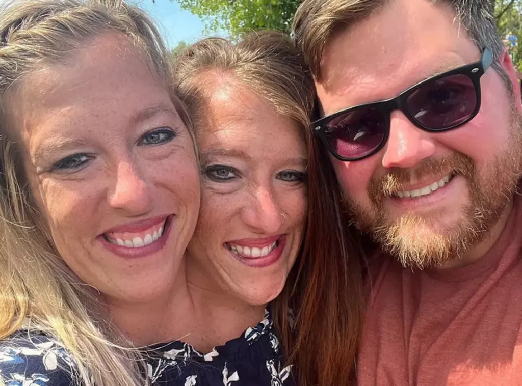 Egyesült ikrek titka: Újszülöttel látták a Hensel nővéreket!-1