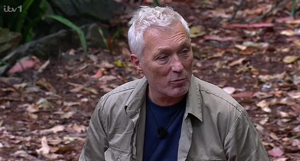 Martin Kemp: Rákműtét okozta diszlexiája sokkolta a nézőket!-2