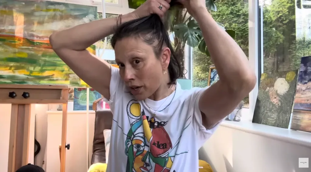 Melanie Sykes: Két harmadára kopasz! Sokk egészségfrissítés-2