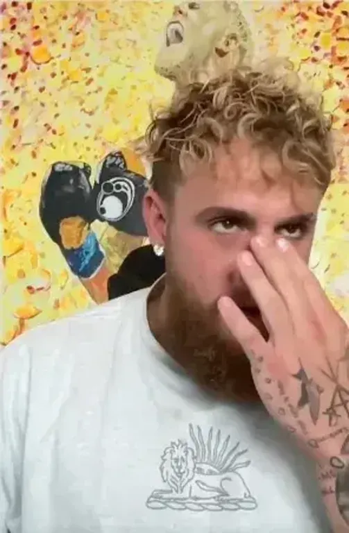 Jake Paul ijesztő sérülést villant: Joshua ellen még mindig megy?-2