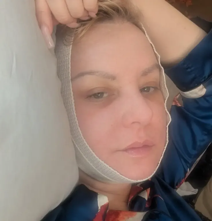 Bridesmaids-sztár kihagyta az Oscar-reuniót nyaki lift miatt!-3