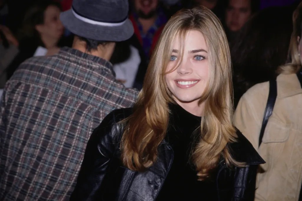 Denise Richards arcplasztikája: Váratlan bőrjavulás!-1